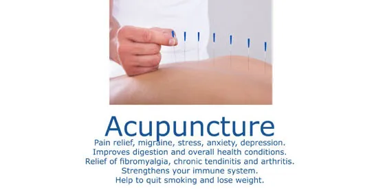 Acupuncture Marbella